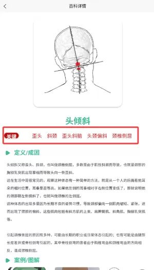 BodyLang体态评估