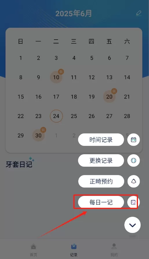 牙套日记